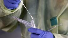 Gravi carenze di tamponi e altre forniture ostacolano i test del coronavirus 