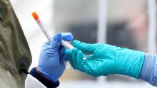 I grandi laboratori commerciali danno la priorità all'apparecchiatura federale per il test del coronavirus