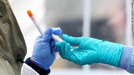 I grandi laboratori commerciali danno la priorità all'apparecchiatura federale per il test del coronavirus